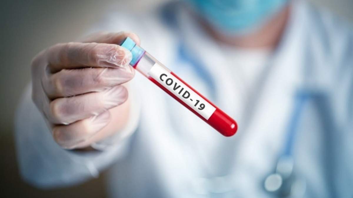 Permanentes muestras y estudios para determinar el coronavirus. Fuente: (Twitter).