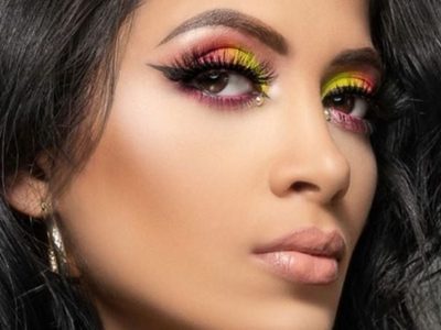 ¡¿Por dios, qué es ESO?! Kimberly Flores sorprende a sus fans con el estado de sus pantorrillas ¡No