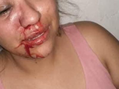 Soy Alina y temo por mi vida porque mi esposo se volvió mi agresor, denuncia la mujer en redes