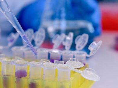 Coronavirus: otra vez Cipolletti volvió a ser la ciudad rionegrina con más casos