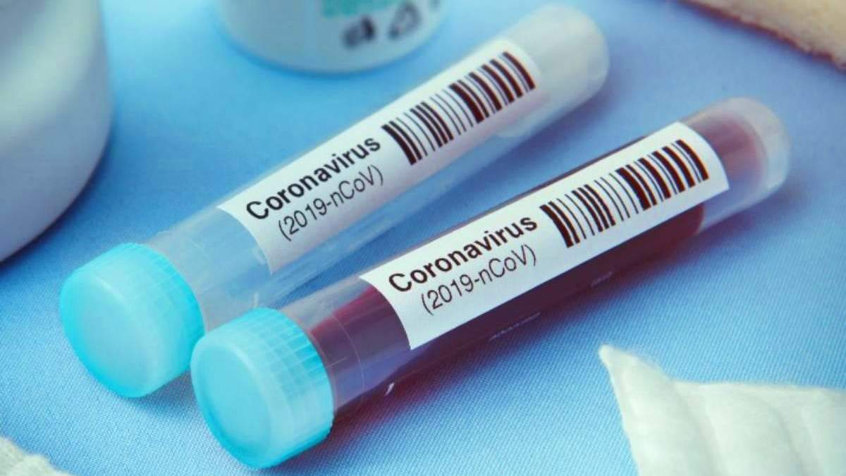 Coronavirus. Fuente: (Twitter)