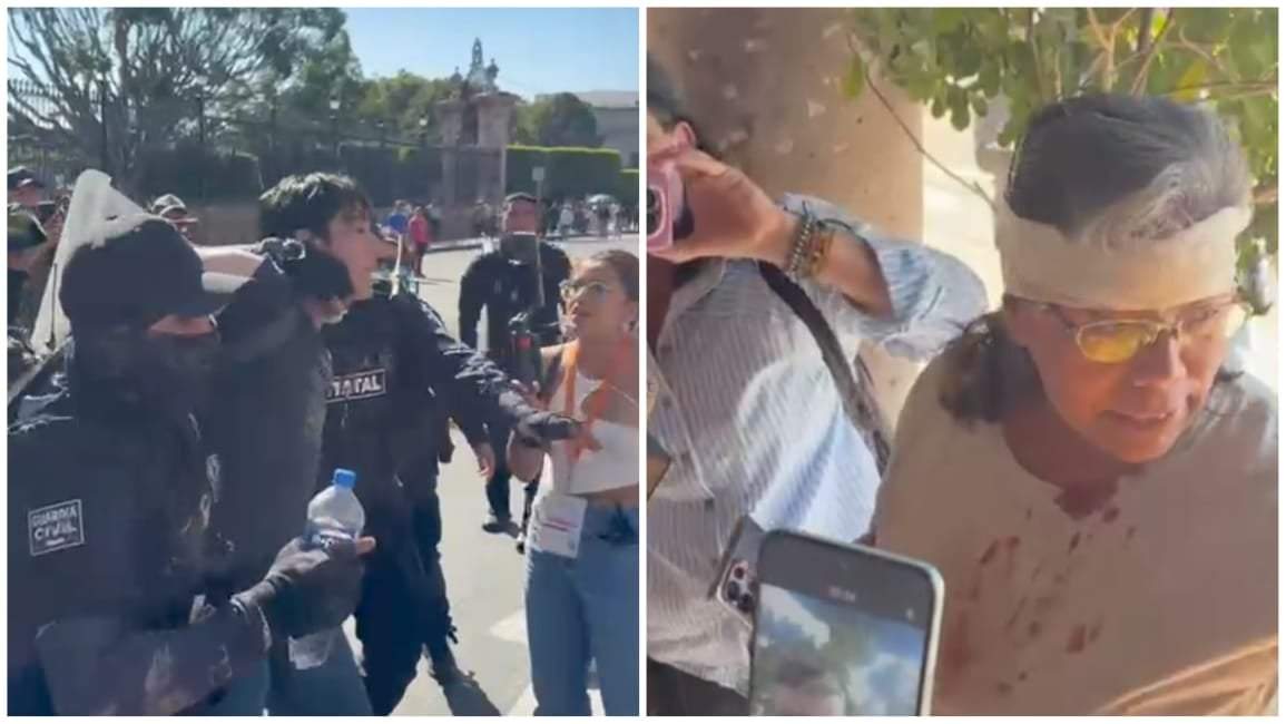 El fotógrafo Jafet Pineda, quien fue sometido, esposado y golpeado, y la periodista Liliana Jiménez Nieto, quien recibió heridas en el rostro, ambos agredidos por la Guardia Nacional estatal en la marcha de la Generación Z