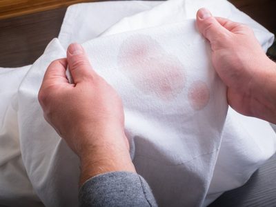 El trucazo de las abuelas para eliminar las manchas de tus remeras blancas con solo 1 producto de tu botiquín
