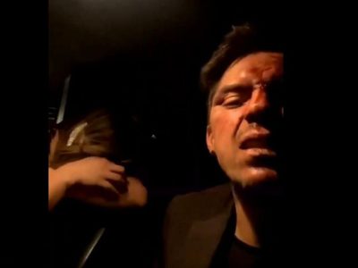 Renata Escorcia denuncia agresión sexual en fiesta donde golpearon a César D’alessio