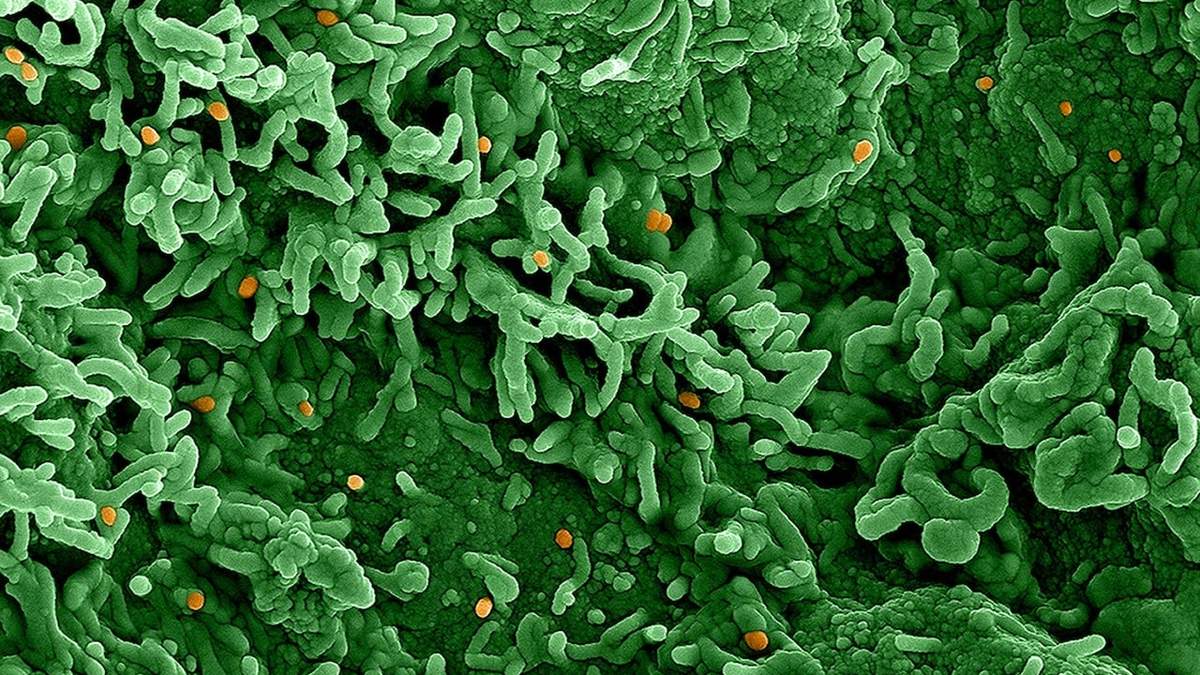 Virus de la viruela del mono simica