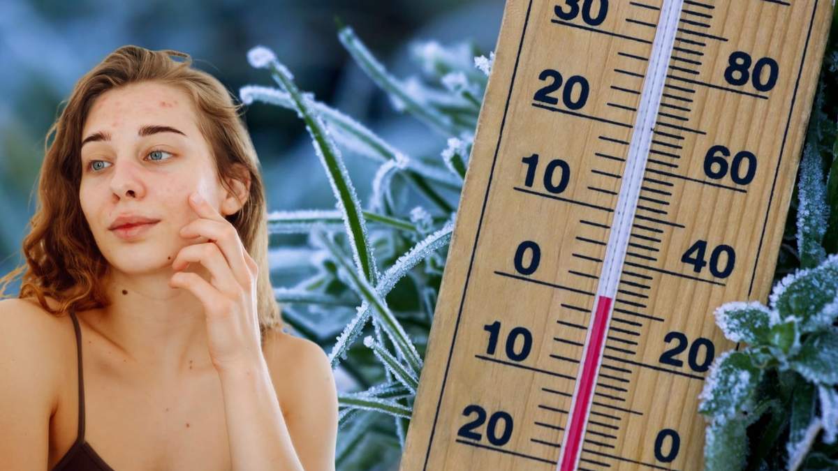 La alimentación es uno de los factores que influyen en la salud de la piel durante el invierno.