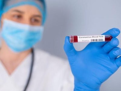 Con 3 nuevos casos confirmados: Neuquén llega a los 102 infectados