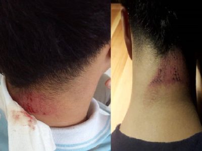 Una placa de yeso cayó sobre la cabeza de un alumno de la EPET 21 de San Martín de los Andes