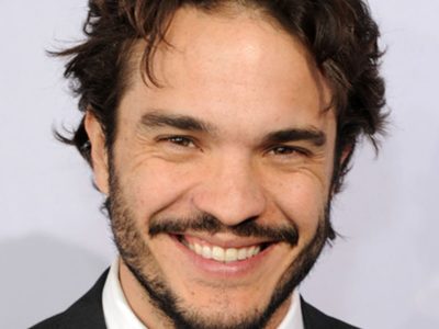 ¡Con uso medicinal! Kuno Becker confesó que acude al botox para tratar una enfermedad