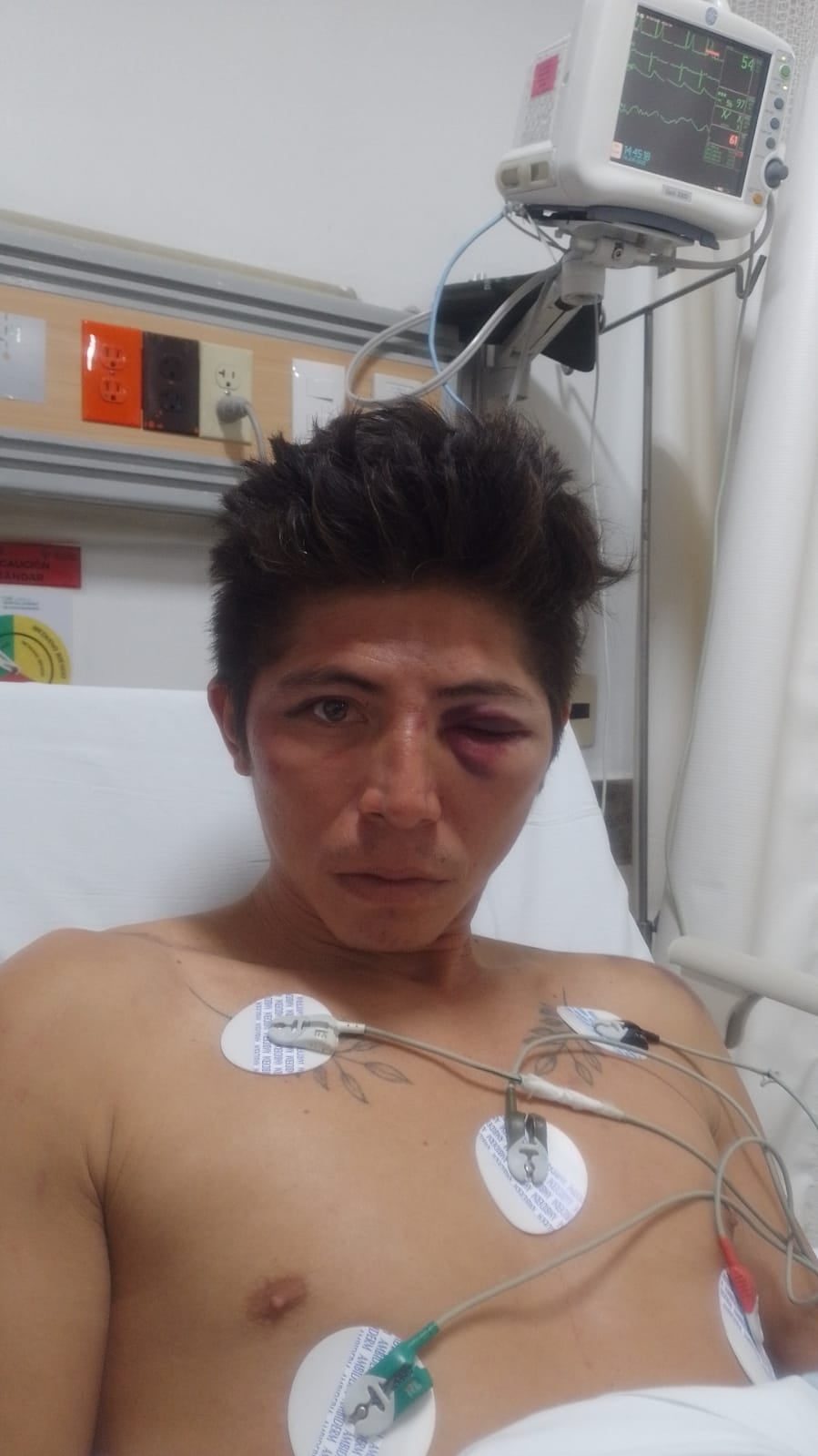 Uno de los hermanos agredidos por policías de Campeche