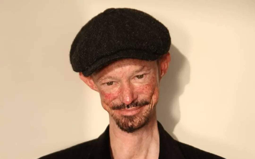 El actor Darren Kent, quien participó en Juego de Tronos