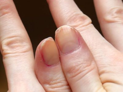 Si ya no sabés qué hacer para que tus uñas crezcan, probá este milagroso truco de las abuelas que nunca falla