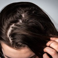 Si tenés el cabello muy graso, prepará esta mascarilla "mágica" para dejarlo totalmente hermoso