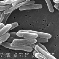 Repunta la tuberculosis: en 2023 alcanza la cifra de casos más alta en una década