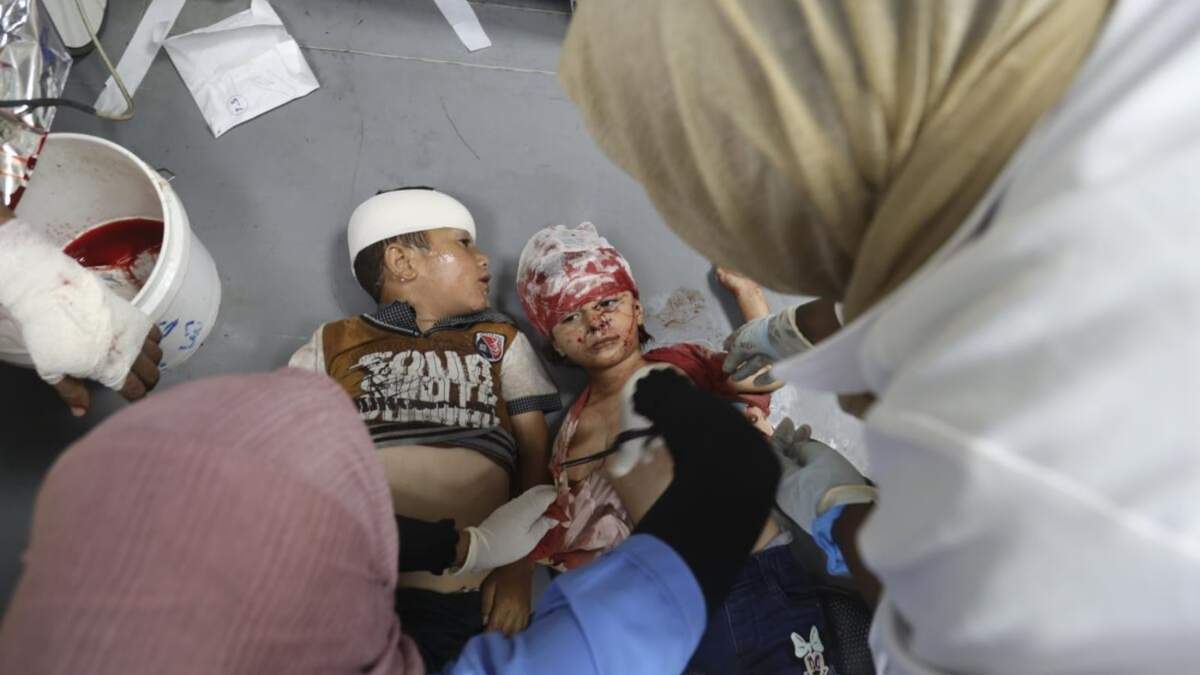 Niños palestinos heridos luego de un bombardeo israelí en la Franja de Gaza son atendidos en el Hospital de Al Aqsa, en Deir al Balah