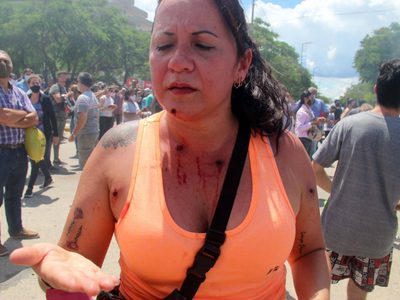 Human Rights Watch repudió la represión en Formosa