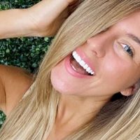 ¡Impactante! Loly Antoniale ya no será la misma de antes. ¿Qué le pasó? ¡Temía lo peor y lo hizo!