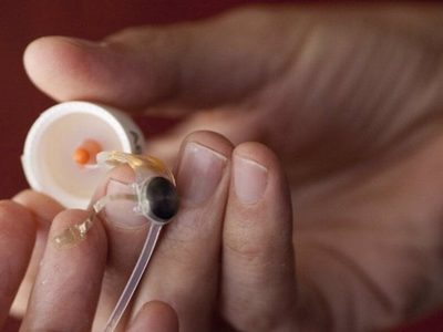 Los ojos biónicos de más de 350 personas quedan obsoletos tras quiebra de empresa
