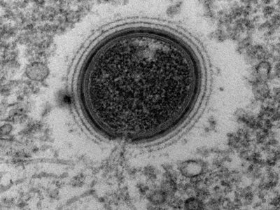 El calentamiento global aumenta el riesgo de futuras epidemias