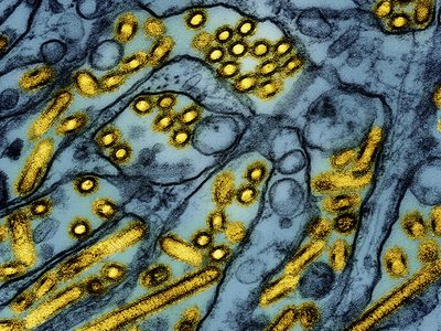 Luisiana registra primera persona con gripe aviar grave y California declara emergencia