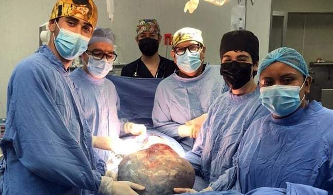 Equipo médico del IMSS de León, Guanajuato, le extirpa un tumor de 21 kilos a una mujer de 60 años