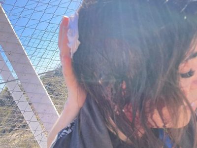 Parque Norte: atacaron a una mujer con una piedra