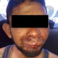 Pobladores golpean a hombre acusado de agresión sexual contra menor en el Estado de México