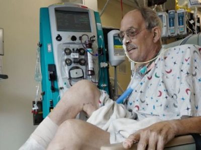 Un mes después de un trasplante de corazón porcino, paciente no muestra señales de rechazo