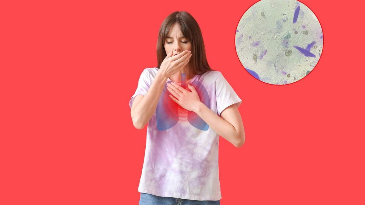 Tos por más de dos semanas, fiebre y pérdida de peso pueden ser señales de tuberculosis. Te explicamos qué debes saber sobre su detección y tratamiento.