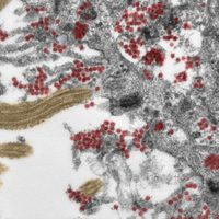 Médicos alemanes descubren cómo el coronavirus entra al cerebro