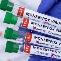 Por primera vez, Estados Unidos detectó casos de viruela del mono en niños