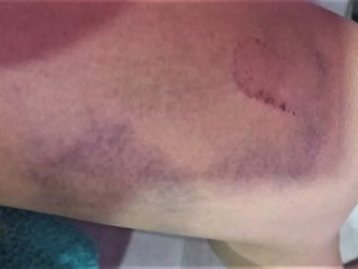 Una mujer que circulaba en bici fue atacada por una jauría de perros sueltos