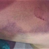 Una mujer que circulaba en bici fue atacada por una jauría de perros sueltos