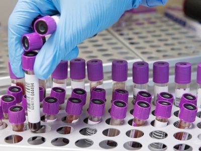 ¡Encontraron una solución para tratar el coronavirus! Continúan las investigaciones en la región
