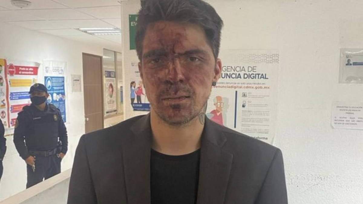 César D'Alessio denunció que fue golpeado y amenazado de muerte por Arturo Montiel