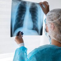 Las últimas novedades sobre avances en fibrosis quística