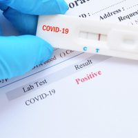 Las farmacias neuquinas venderán test rápidos de coronavirus