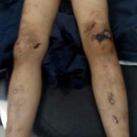 El niño Karol Ramón fue maltratado y golpeado hasta que murió; su madre está presa