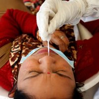 India: el coronavirus desencadenó una enfermedad fúngica letal
