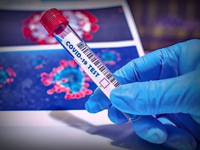 Así fue el último parte sobre los nuevos casos de coronavirus y los fallecidos en la provincia