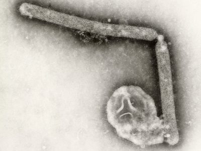 Los CDC detectan posible mutación del virus de la gripe aviar en un paciente de Luisiana