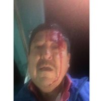 Agreden a batazos a periodista de Comondú, Baja California Sur (Video)