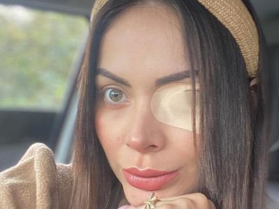 ¡Cuidado! Laura González Díaz casi pierde la visión por utilizar este nuevo producto de moda ¡Mirá!