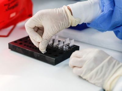 ¡Una buena! Vizzotti anunció el ingreso de 31.000 reactivos para detectar el coronavirus