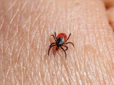 ¿Qué es la rickettsiosis? Dos niños murieron en NL a causa de esta enfermedad
