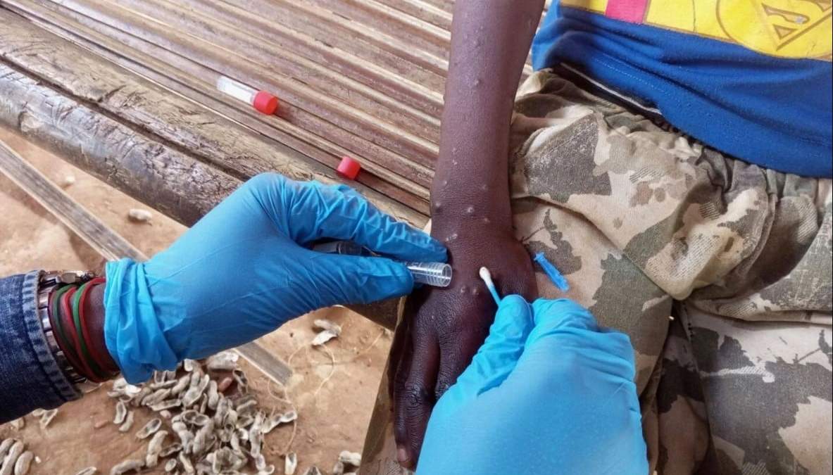 Emergencia sanitaria