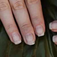 El alimento muy común que tenés en la cocina y que te ayudará a no tener más las uñas quebradizas