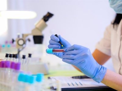 Desarrollan un método de análisis de sangre que ayuda a mejorar los tratamientos contra el cáncer