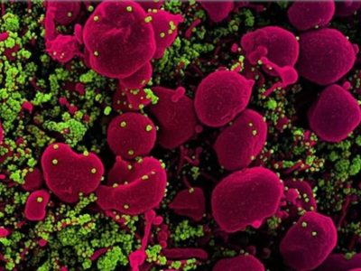 Identifican proteínas clave en células infectadas con SARS-CoV-2