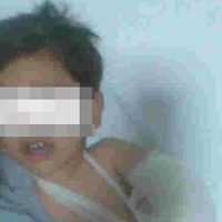 Edward entró al nosocomio con un brazo fracturado y ya no despertó de la anestesia